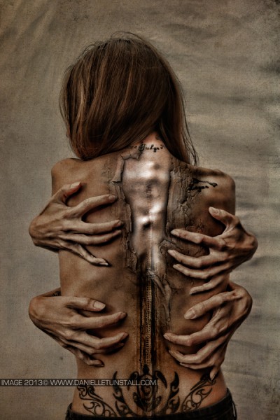 scholiosis